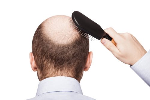 Làm sao để trị dứt điểm gàu và nấm da đầu?