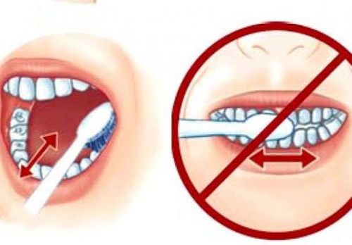 Cách phòng ngừa sâu răng