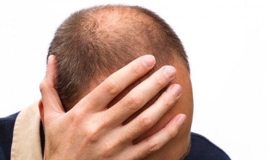 Nguyên nhân gây rụng tóc và cách điều trị hiệu quả